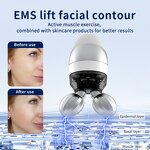 Dual-head RF Beauty Device - EMS Red Blue Light Face Lifting Wrinkle Tool