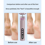 Pedicure Machine Manufacturer - 2in1 Electric File for Feet 2000mAh 9 Gears Dead Skin Remover Callus Trimmer