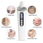 Vacuum Blackhead Removal - Wholesale Pore Cleansing Cosmetic Beauty Tool