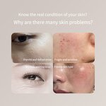 Portable Skin Moisture Analyzer - New ABS LCD USB LED Handheld Tester