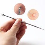 粉刺提取器源头工厂-黑头去除器痘痘工具面部护理用