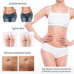 Beauty Device Manufacturer - Beperfect Ems LED Light Therapy Hand-held RF for Skin Tightening & Firming Home Use with US Plug