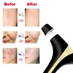 Mini Laser Hair Remover - High Quality Intense Pulsed Light for Women