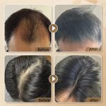 Jamaican Castor Oil - Private Label 100ml Indian Wholesale Kids Men Rosemary