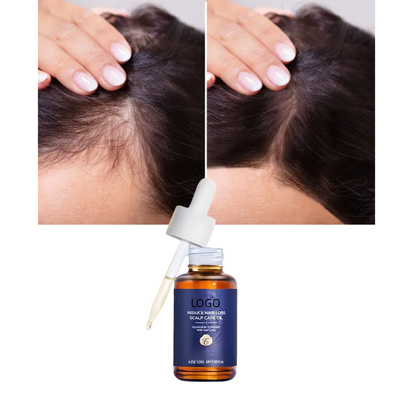 Jamaican Castor Oil - Private Label 100ml Indian Wholesale Kids Men Rosemary