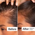 Ginger Hair Shampoo - Private Label Herbal Anti Hair Loss Strengthening