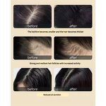 Notoginseng Shampoo Set - 100% Organic Anti-Dandruff Moisturizing Repair