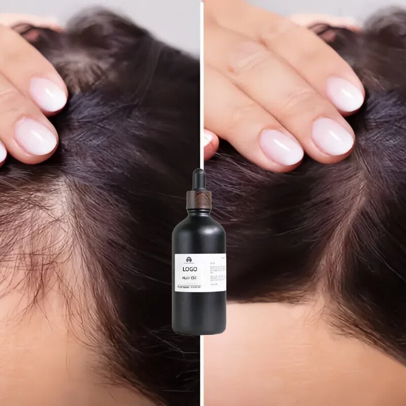 Onion Hair Growth Oil - Spring Tree 50ml Ayurvedic Rosemary Banana Chebe