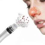 Hydro Dermabrasion Peeling Pen - Portable Home Microdermabrasion Vacuum Device