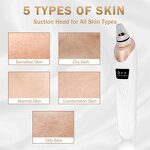 Facial Pore Cleaner Manufacturer - Electric Comedone Whitehead Extractor Rechargeable for Women