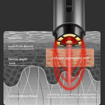 LED Facial Massager - Hot & Cold Red Light EMS Mini Face Lifting Skin Care Device