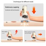 Cupping Machine Manufacturer - 2026 New Patent Physical Therapy Vacuum Suction EMS