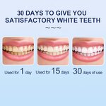 U Shape Whitening Device - Upgraded Red Blue Light Wireless Mini Portable Vibration