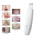 6 in 1 EMS Scrubber - ION LED Photon Skin Lifting Face Spatula Blackhead Remover