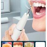 USB Dental Scaler - Health Hygiene Electric Tartar Remove Tooth Cleaner Tool