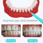 Travel Dental Scaler - New Easy-Carry Waterproof Rechargeable Professional Whitening
