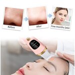 Nano Ultrasonic Scrubber - Professional Home ABS Waterproof Deep Cleaning Face Spatula