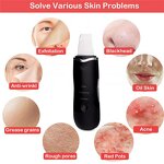 Sonic Facial Spatula - Peeling Machine - Spray Moisturizing Blackhead Remover Deep Cleaning