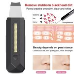 Ultrasonic Skin Scrubber - 2024 Handheld - Waterproof Face Peeling Blackhead Remover