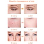 3 Color LED Photon Mask - Manufacturer Wholesale - Home Use Face Facial Beauty Skin Care