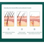 Laser Hair Removal Device Manufacturer - Novel Portable Electric Cooling Ice Epilator