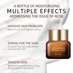 Acne Cream Manufacturer - Strong Moisturizing Soothing Repair for Acne Prone Skin