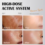 Face Serum Manufacturer - Maycheer Niacinamide 35ml Speed Spot Fading Brightening