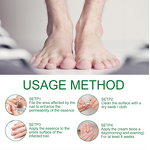 Serum - Manufacturer Herbal Anti Fungal Nail Repair Onychomycosis Feet Care