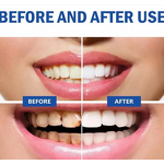 Toothpaste - Manufacturer 3pc Herbal Oral Care Whitening Adult Home Use