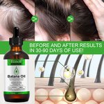 Batana Oil - Manufacturer Private Label 120ml Cold Pressed Anti Hair Loss Scalp
