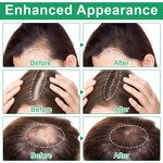 Hair Growth Serum - Manufacturer 20ml No-Rinse Rosemary Biotin Anti Hair Loss