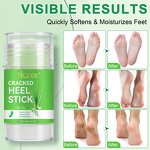 Aloe Foot Balm - Manufacturer 40g Aloe Vera Urea Salicylic Acid Moisturize