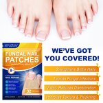Fungal Nail Patches - Manufacturer 32Pcs Private Label Overnight Anti Fungal