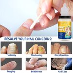 Nail Fungus Drops - Manufacturer 10ML Oregano Tea Tree Finger Toenail Repair