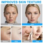 Hyaluronic Acid Powder - Manufacturer Private Label Ultra-Pure Cosmetics Grade DIY