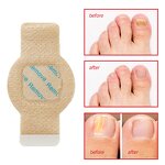 Fungal Nail Patches - Manufacturer Private Label Overnight Repair Anti Fungal