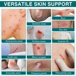 Hydrocolloid Bandages - Manufacturer Flexible Waterproof Medical Wound Care