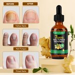 Nail Repair Oil - Manufacturer Private Label 60ml Ginger 7 Days Fungal Growth
