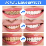 Soda Toothpaste - Manufacturer Fruit Flavor Stain Removal Oral Healthy