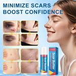 Scar Removal Cream - Manufacturer Private Label 20g Cocoa Butter Silicone Scar