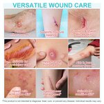 Hydrocolloid Bandages - Manufacturer Private Label Waterproof Breathable Wound