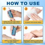 Scar Removal Cream - Manufacturer Private Label 20g Cocoa Butter Silicone Scar