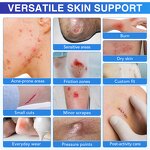 Hydrocolloid Bandages - Manufacturer 5CM*1.5M Waterproof Medical Wound Care