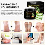 Frankincense Foot Cream - Manufacturer 150g Natural Organic Soreness Revitalize