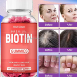 Biotin Gummies Manufacturer - Private Label Hair Growth with Collage Keratin