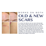 Scar Removal Gel - Manufacturer OEM/ODM Medical-Grade Silicone Burn Surgical