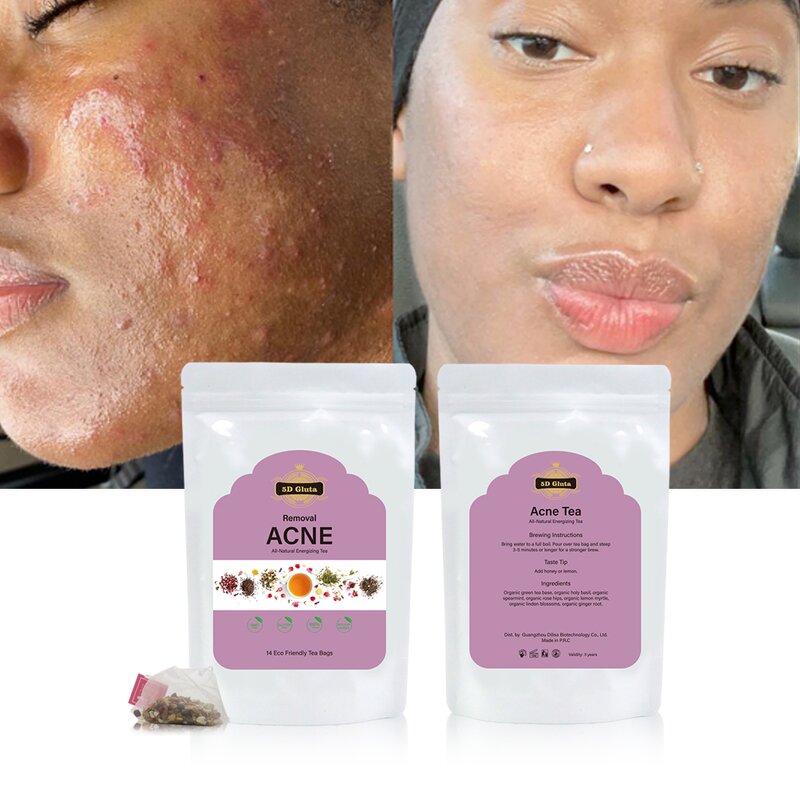 Detox Glow Tea - Manufacturer Private Label All-Natural Energizing Skin Whitening