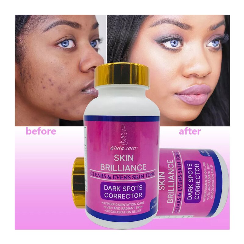 Skin Brightening Pills - Manufacturer OEM Logo Vitamin Collagen Acne Whitening Capsule