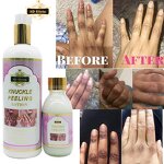 Knuckle Peeling Lotion - Manufacturer Miracle Whitening Elbow Knee Half Cast 500ml