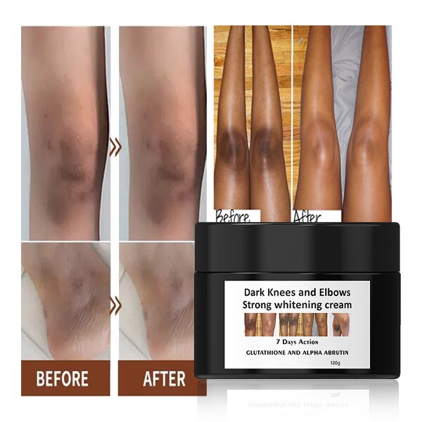 Whitening Cream - Manufacturer Gluta Master OEM 7 Days Dark Spot Corrector African Skin